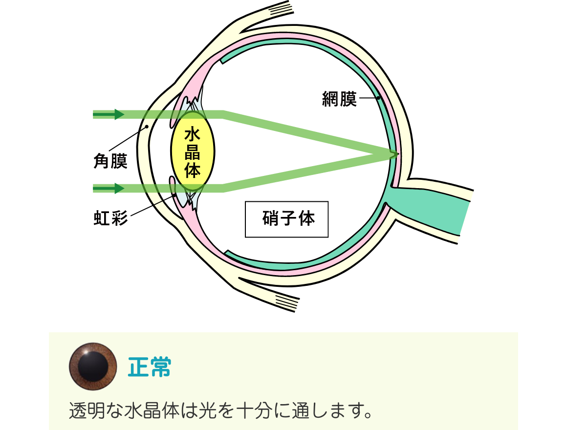 正常