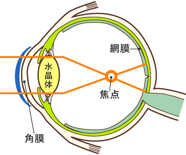 近視の状態